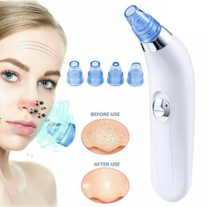 Pro Vacuum Suction Blackhead Remover